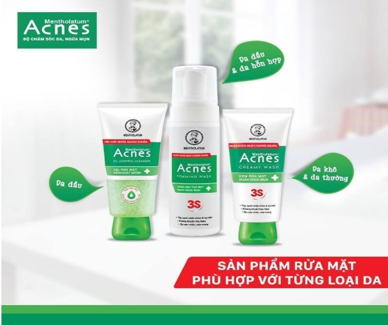 Review Sữa Rửa Mặt Acnes Trị Mụn Có Tốt Không? Có Mấy Loại, Mua Ở Đâu, Giá Nhiêu