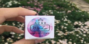 Kem Trị Mụn Mỹ Lyn Có Tốt Không? Giá Bao Nhiêu Một Hộp? Mua Ở Đâu Cập Nhật 08-2025