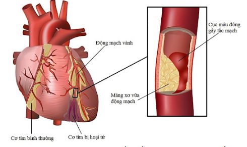 Cách Dùng Các Loại Thuốc Hạ Mỡ Máu Sao Cho Hiệu Quả Cập Nhật 11-2024